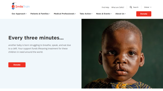 Homepage of Smile Train showing a child with cleft and text about lifesaving treatment every three minutes with a donate button.
